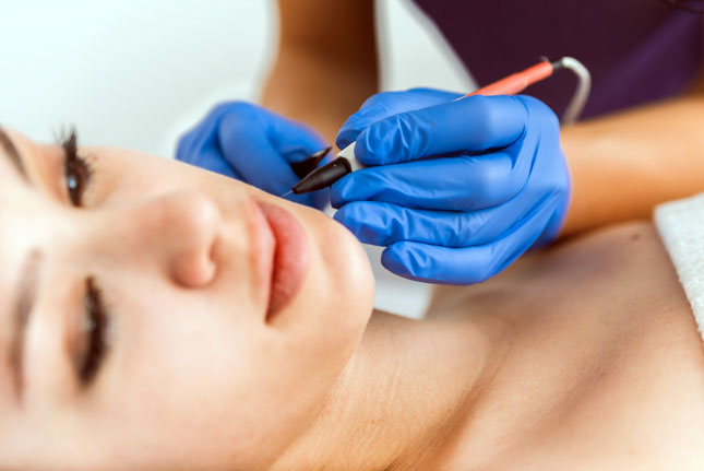 Electrolysis Training Courses - close up of hair removal