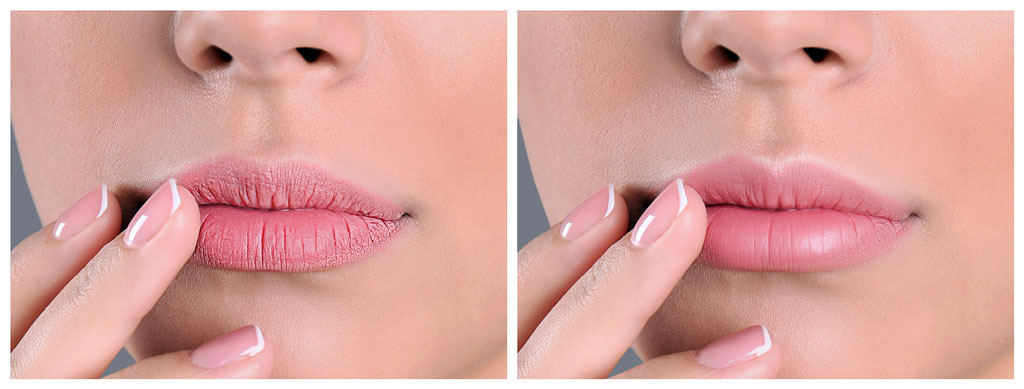 Polynucleotides lips before and after treatment