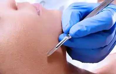 Dermaplaning Facial Training Course Image