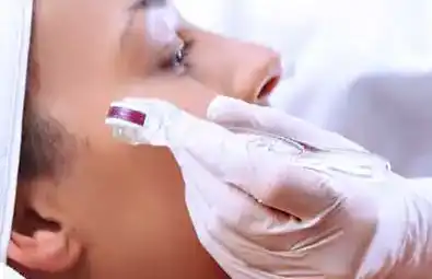 Microneedling Training Course Image