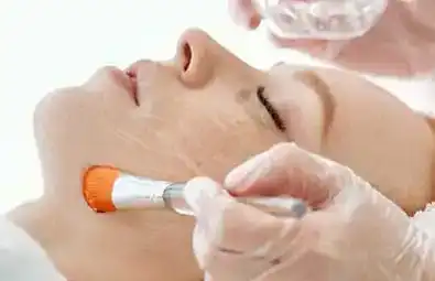 TCA Advanced Skin Peels Training Course Image