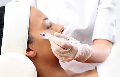 Microneedling Training Course